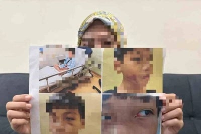 Ibu mangsa menunjukkan kecederaan yang dialami anaknya disyaki akibat dibuli. 