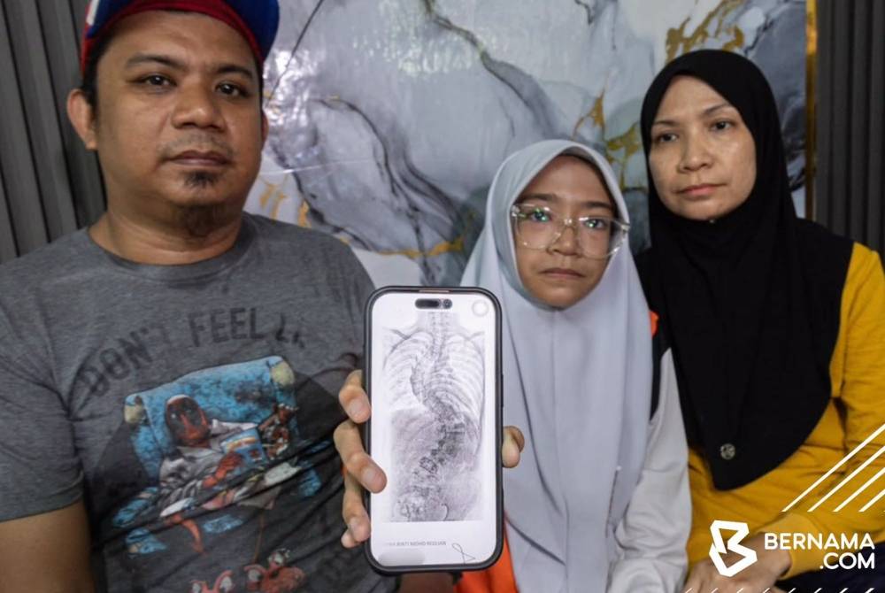 Reduan (kiri) berkata, dia hanya menyedari Arissa El Zahra (tengah) menghidap penyakit itu ketika anak perempuannya berusia 10 tahun selepas mendapati kedua-dua bahunya tidak seimbang dan tulang belakang mula membengkok.