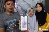 Reduan (kiri) berkata, dia hanya menyedari Arissa El Zahra (tengah) menghidap penyakit itu ketika anak perempuannya berusia 10 tahun selepas mendapati kedua-dua bahunya tidak seimbang dan tulang belakang mula membengkok. 