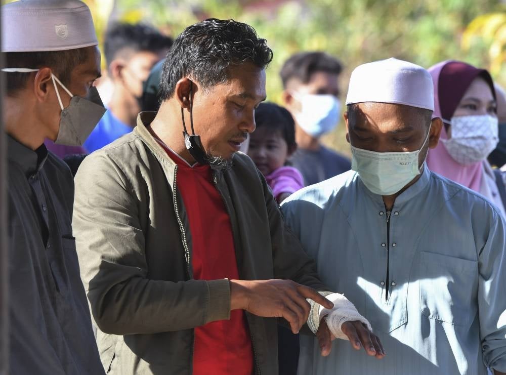 Mohd Nazri Hamid, 44, showing his hand that was injured in the accident. - BERNAMA