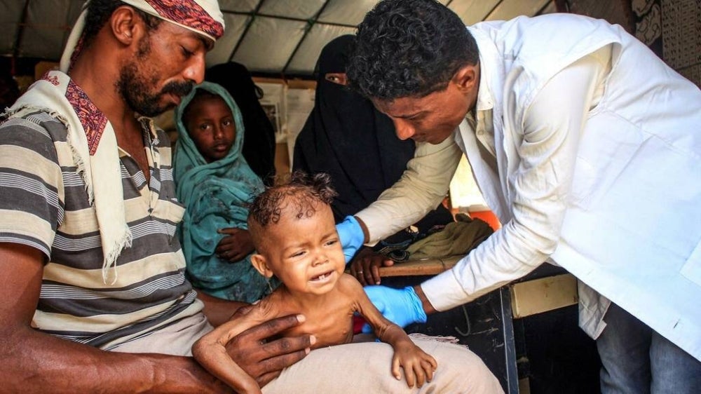 Three-year-old Yemeni child Randa Ali, suffering from severe acute malnutrition, is carried by her father in the Abs district of Yemen's northwest on February 19. - AFP Photo