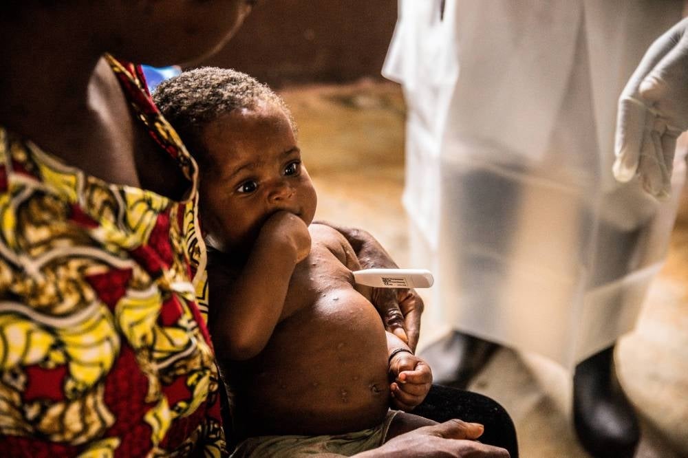 A woman and her child, both infected with monkeypox await treatment at the quarantine of the centre of the International medical NGO Doctors Without Borders (Medecins sans frontieres - MSF), in Zomea Kaka, in the Lobaya region, in the Central African Republic on October 18, 2018.(Photo by CHARLES BOUESSEL / AFP)