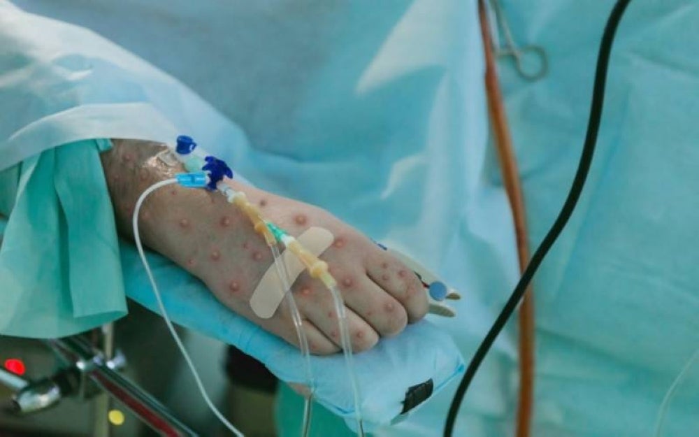 The man had left his apartment and checked into a hotel after being informed of the initial positive test result on July 18. Illustration photo: 123RF