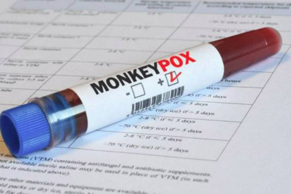 The patient decided to seek medical treatment a week later after he developed rash on the face and that subsequently spread to other parts of the body. - Photo: Sinar Harian