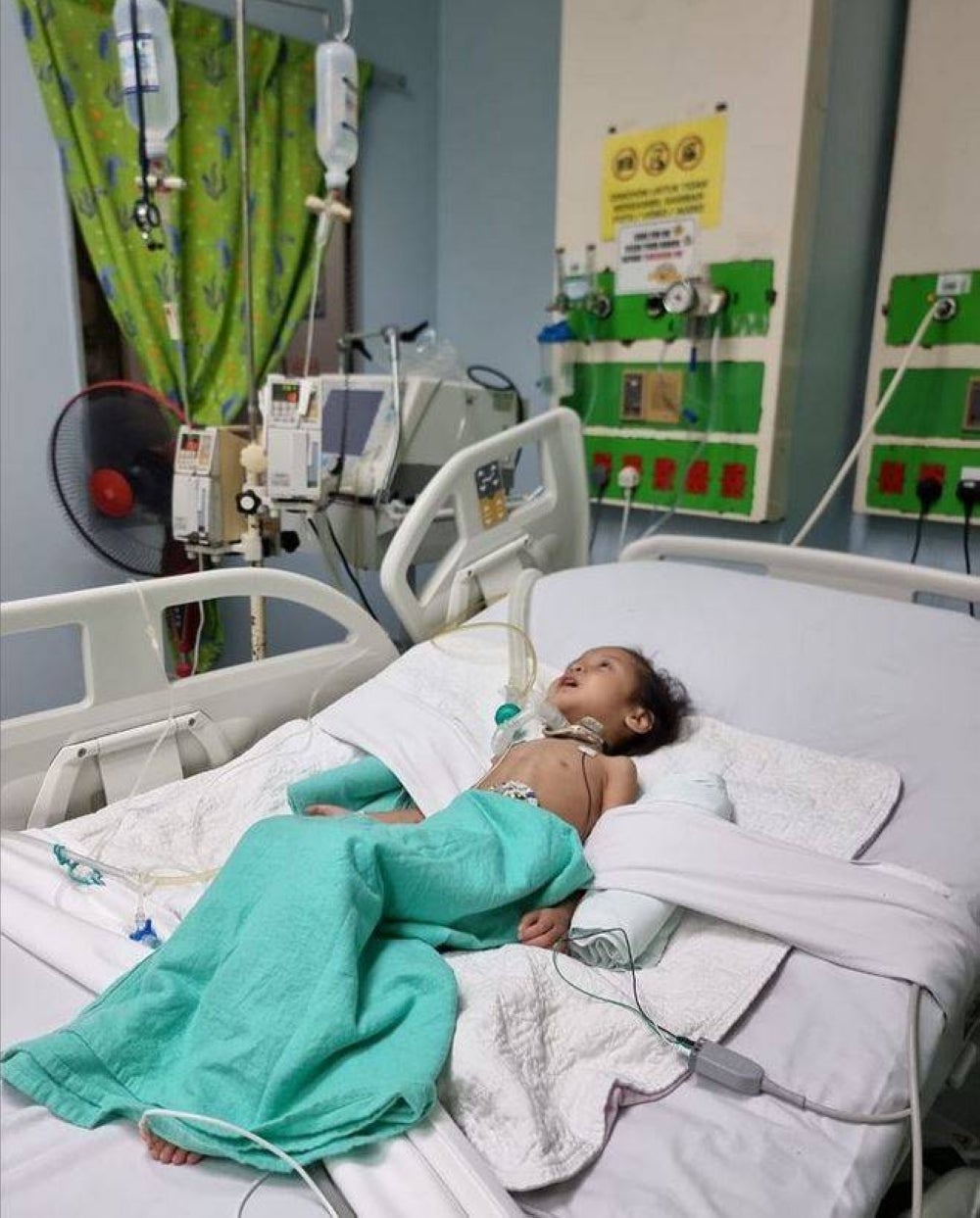 Ainul Mardhiah, four, was diagnosed with a rare germ cell tumour as a baby