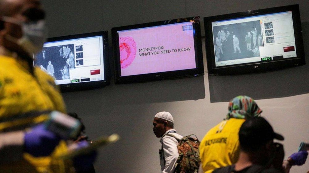 Although no cases of monkeypox had been recorded in the country, early prevention and control measures needed to be done. - Getty Image