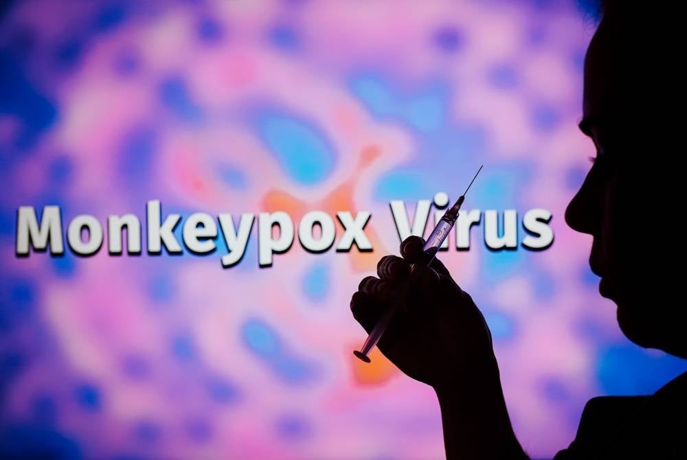 The monkeypox virus is unlikely to be eliminated from the United States in the near future. - 123RF Photo