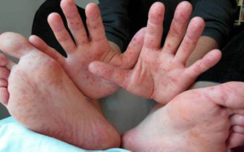 For illustration purpose