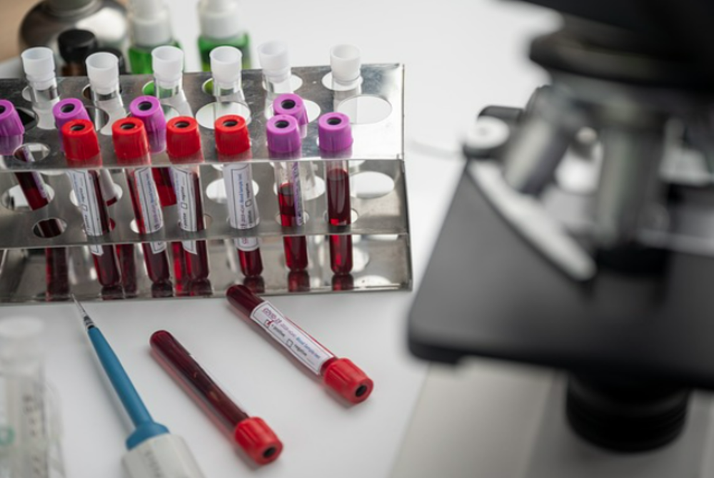 Image for illustrative purposes only. - FILE PIX