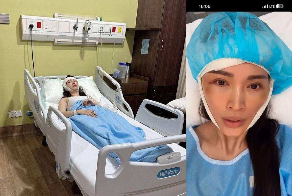 Amber explained that she had blacked out and slipped on the stairs, causing her to fall.