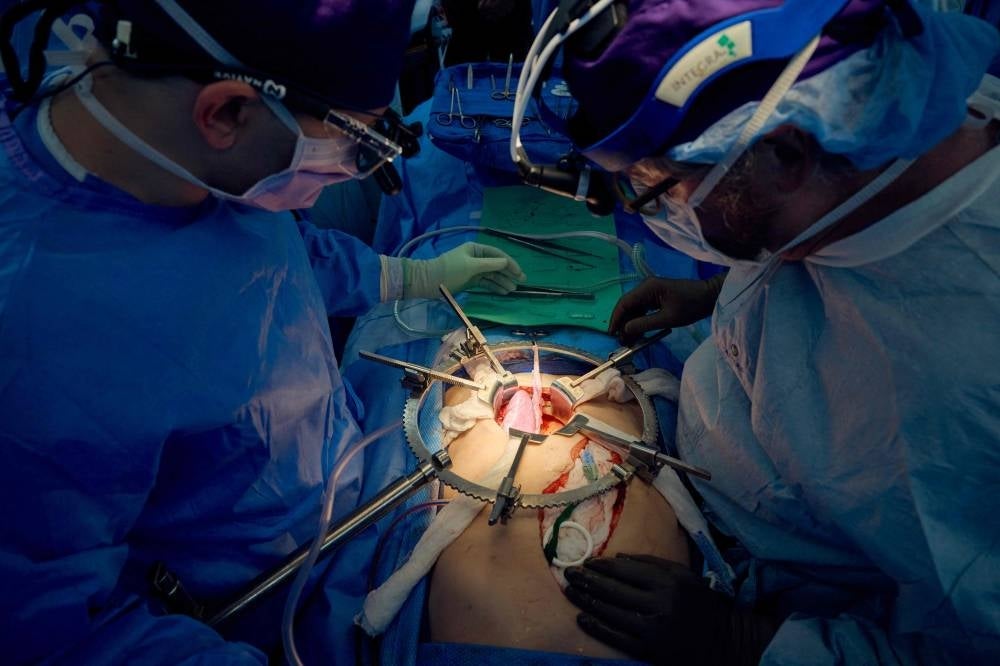 On July 14, 2023, image released by NYU Langone Health in New York, shows a team of surgeons transplanting a pig kidney. - Photo by Joe Carrotta / NYU Langone Health / AFP