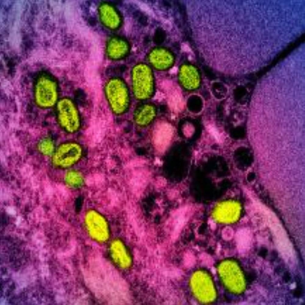 This undated image obtained from the National Institute of Allergy and Infectious Diseases (NIAID) in Bethesda, Maryland, shows a colorised transmission electron micrograph of monkeypox particles (green) found within an infected cell (pink and purple), cultured in the laboratory. - (Photo: AFP / National Institute of Allergy and Infectious Diseases)