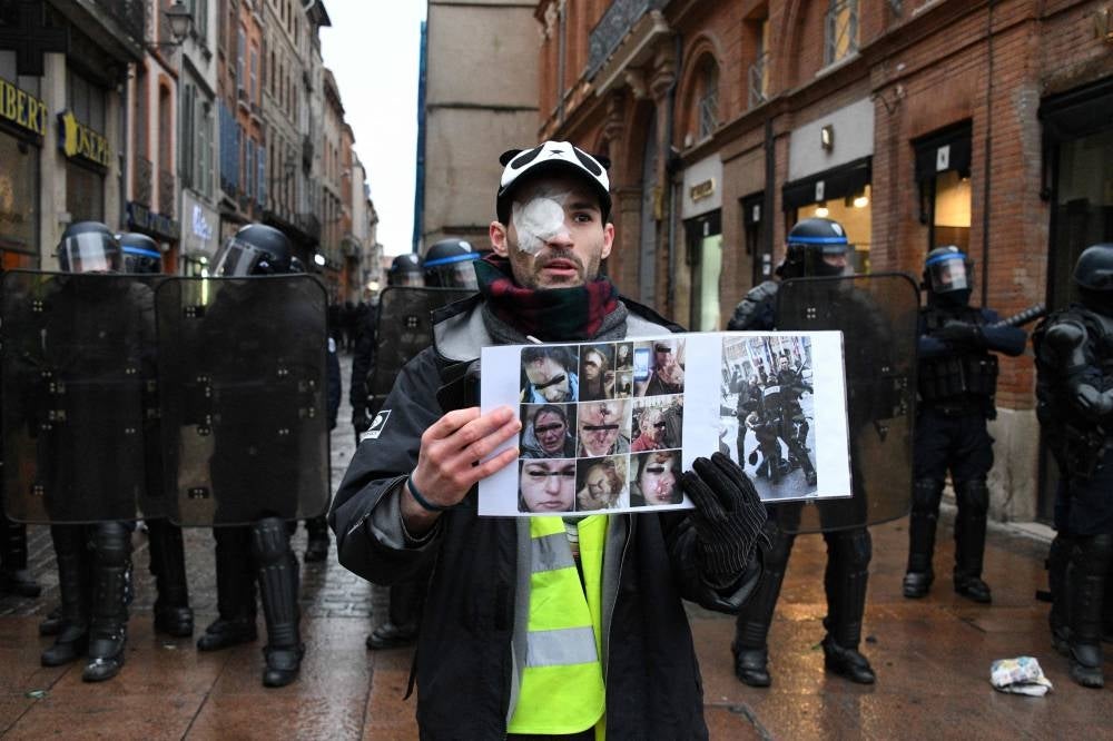 (FILES) An injured protester poses with portraits of people who were allegedly injured in clashes with police during an anti-government demonstration called by the 