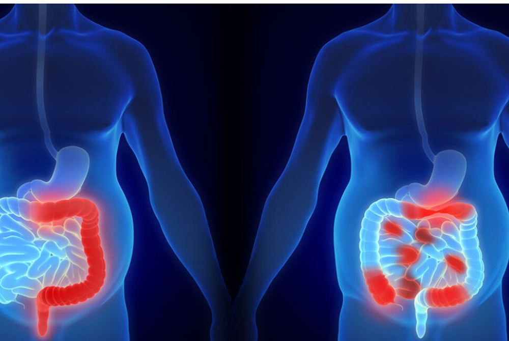 Pix for illustration purpose only. - FILE PIX