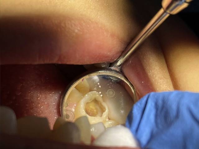 Photo for illustration purposes only. - BERNAMA FILE PIX