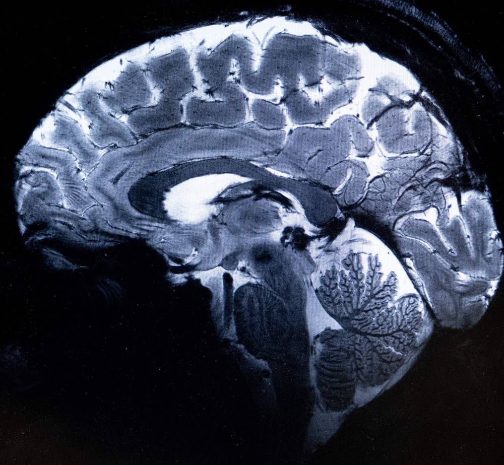This image made with the Iseult Magneton 11.7 T MRI shows a brain during an MRI exam simulation. Photo by Alain Jocard/AFP