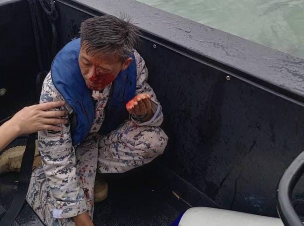 The injured MMEA personnel had undergone surgery to remove a bullet from his eye and was in stable condition.