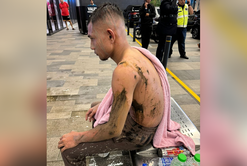 Mohd Sadek Mustafa said that the effects experienced by Faisal not only involve physical injuries but will also affect the player's psychology.