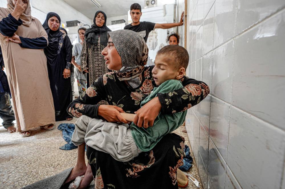 The body of Eyad Hegazi, a 10-year-old Palestinian child suffering from malnutrition and displaced from Shejaiya, rests in the arms of his sister after he died at the Aqsa Martyrs hospital in Deir el-Balah in the central Gaza Strip on June 14, 2024. - (Photo by BASHAR TALEB / AFP)