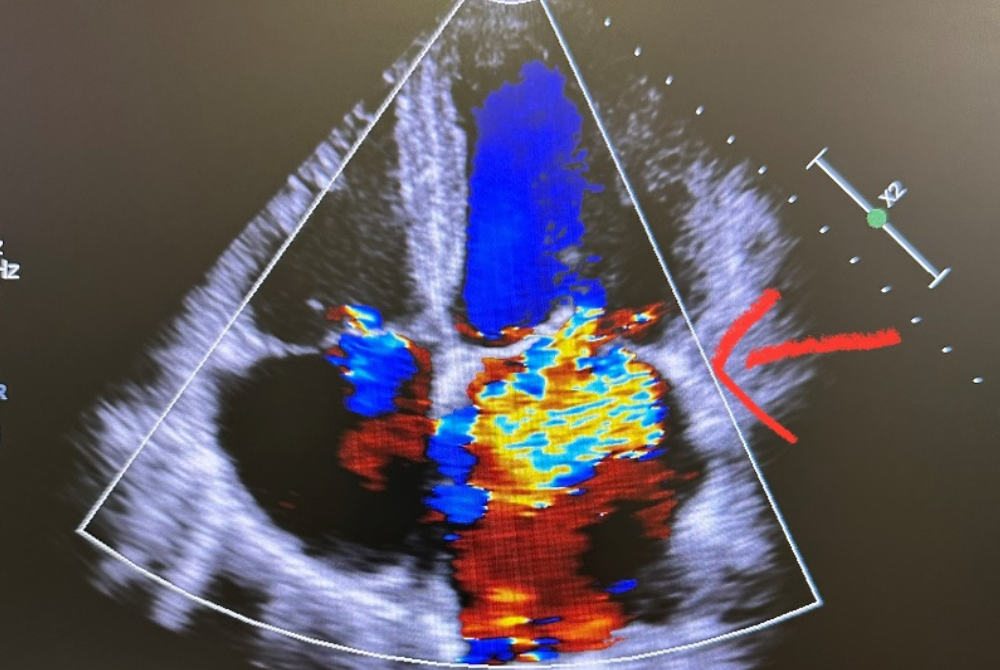 Photo for illustration purpose only. - File photo by Sinar