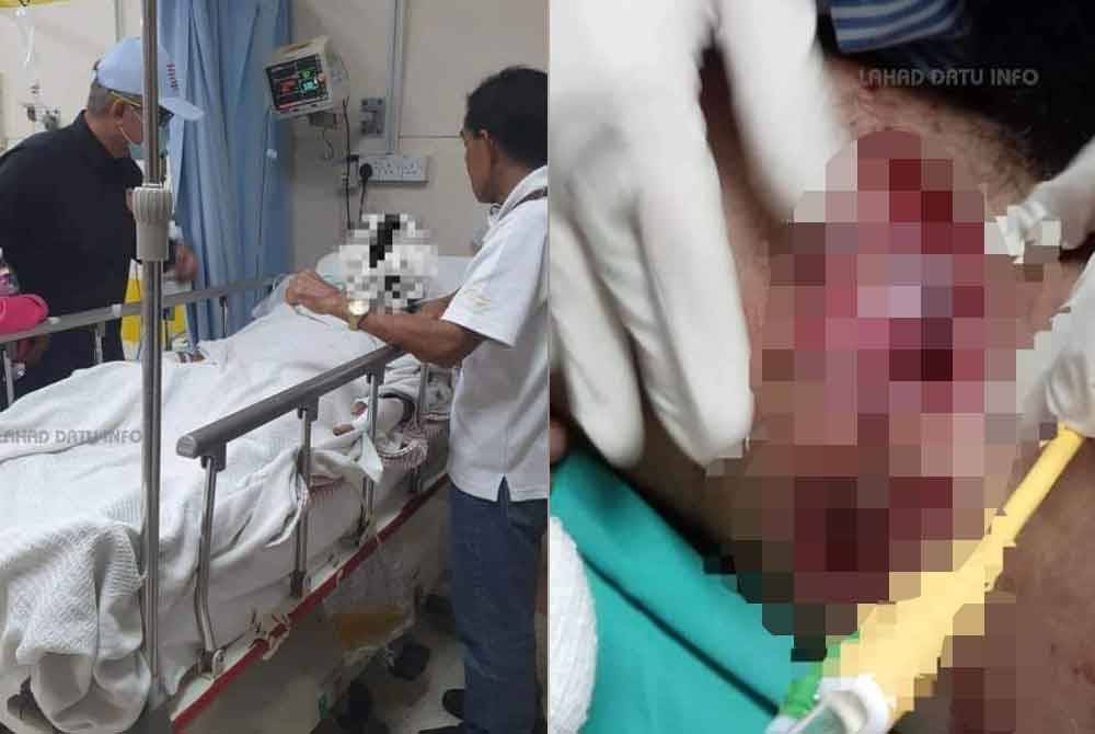The victim is in stable condition and being treated at Tawau Hospital after being attacked by a crocodile.
