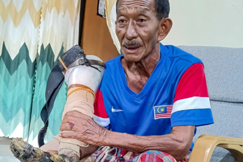 Corporal (Rtd) Sulaiman Maaraof considers the consequences of stepping on a booby trap set by communist terrorists during Op Bersih in Grik around 47 years ago as insignificant compared to the suffering that would have occurred if the country had lost its freedom and independence and returned to colonial rule. - Photo by Bernama