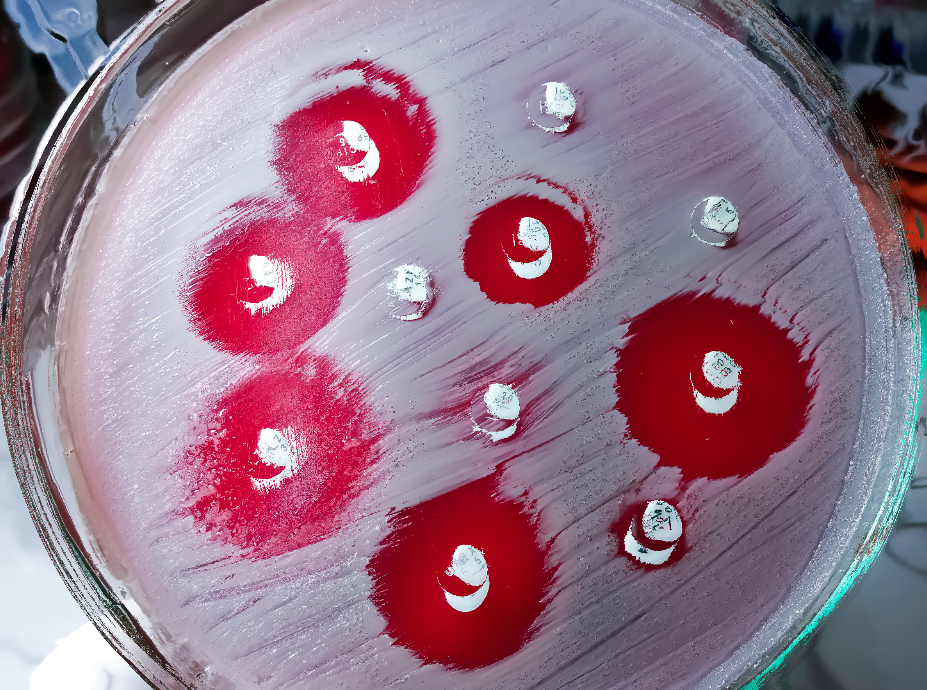 Photo for illustration purpose only. - Photo illustrated by Sinar Daily