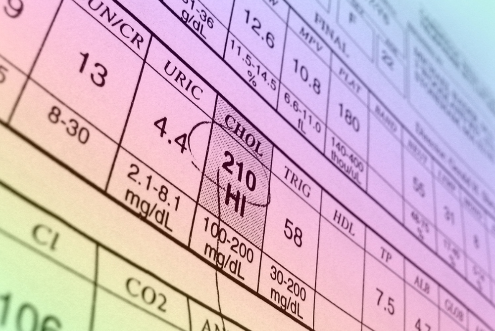 Effective management and prevention of high cholesterol hinge on regular screening and monitoring, which are crucial for identifying individuals at risk and facilitating timely interventions. - Photo illustrated by Sinar Daily