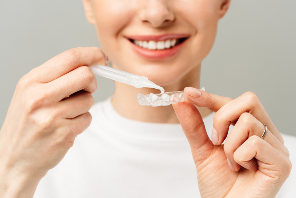 How do DIY teeth whitening kits work? Photo: Canva 