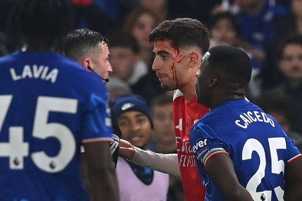 Arsenal's German midfielder Kai Havertz sustains a head injury during the English Premier League football match between Chelsea and Arsenal at Stamford Bridge in London on November 10, 2024. (Photo by Glyn KIRK / AFP)