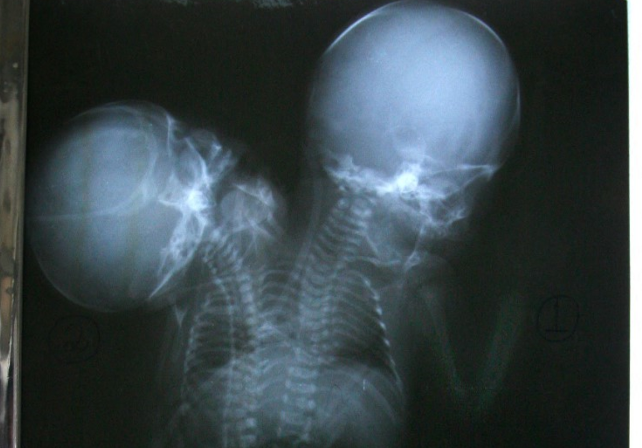 Photo for illustration purposes only. - (Photo by AFP)