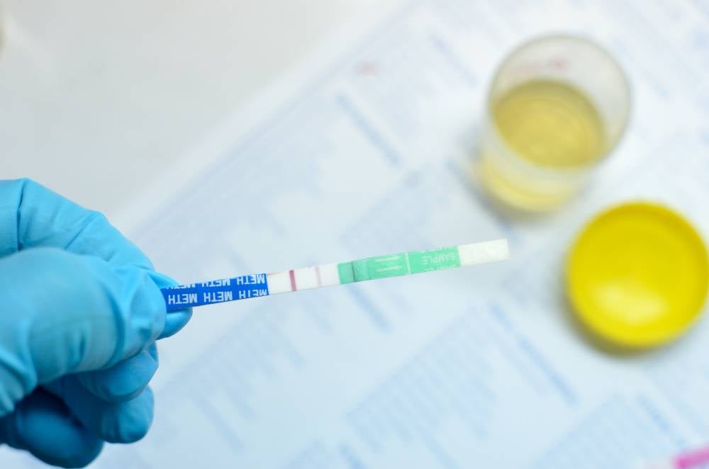 The proposal to conduct drug urine tests before admission to concerts in Selangor will only apply to individuals who raise suspicions. Photo for illustrative purposes only - 123RF
