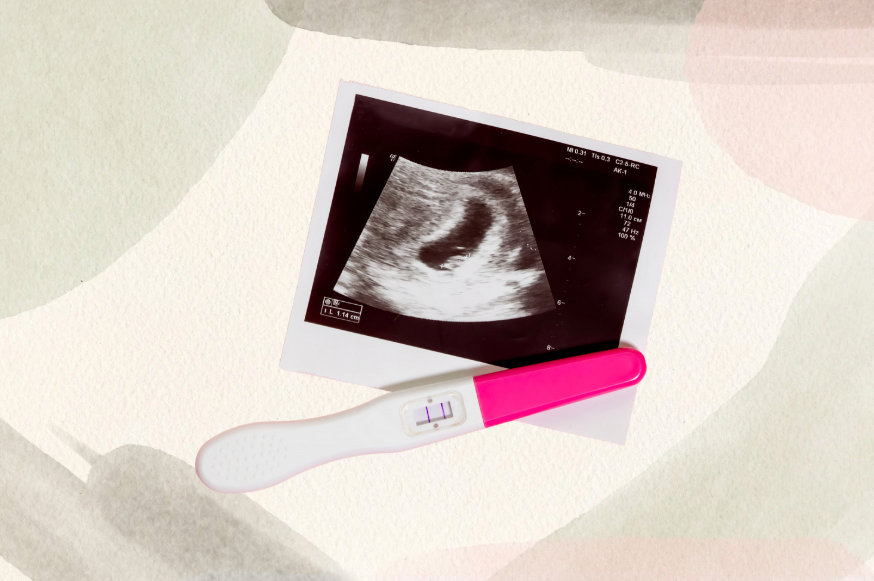 Photo for illustrative purposes only - Canva.