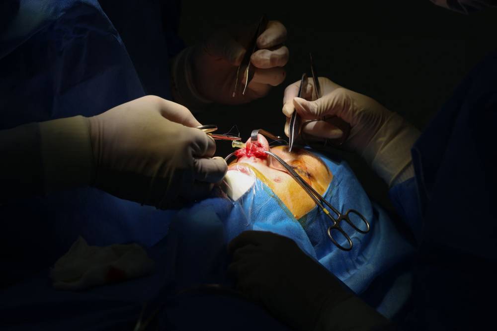 Iranian surgeon Hamidreza Hosnani performs a nose operation at his private clinic in Tehran, on March 4, 2025. g for more than a dozen operations —mostly on women hoping to fix what some call the 