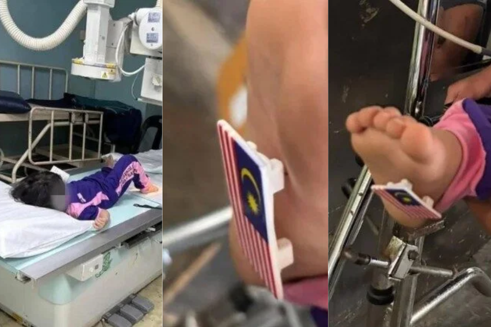 A schoolgirl was hospitalised after stepping on a sharp pin from a Jalur Gemilang badge, prompting public outcry over a policy implemented by the Education Ministry. Photo: Facebook