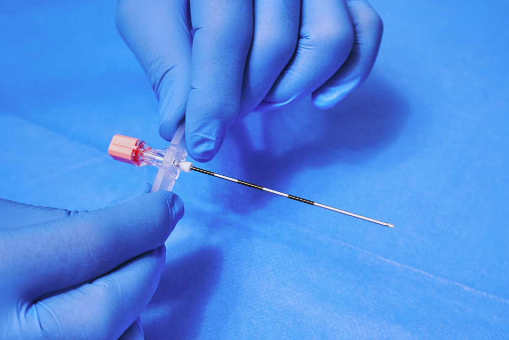 THE use of epidurals as an anaesthetic during childbirth came under the spotlight on social media recently with some netizens equating the procedure to a "cheat code" to avoid pain during delivery. Photo for illustrative purposes only - Canva.