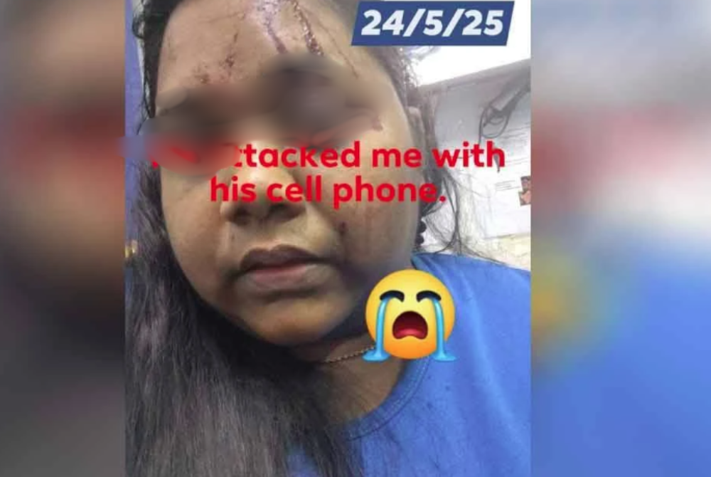 According to the woman, this was not the first time she had been subjected to violence by her husband.