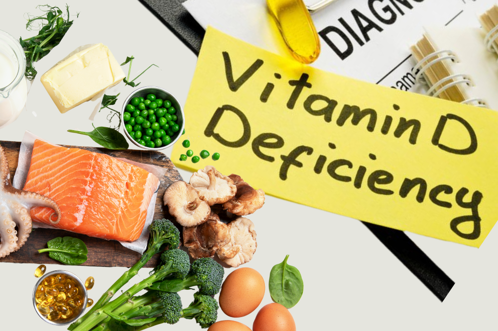 Image for illustrative purposes only. - CANVA