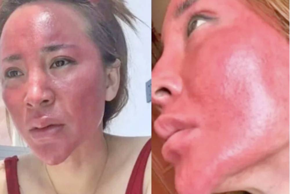 Gao claimed that her face became swollen, distorted and unrecognisable. – Agency