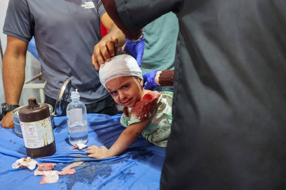 TOPSHOT - Palestinian casualties of an Israeli strike on an apartment at the Nuseirat refugee camp, receive care at Al-Awda hospital in the central Gaza Strip on July 19, 2025. (Photo by Eyad BABA / AFP)