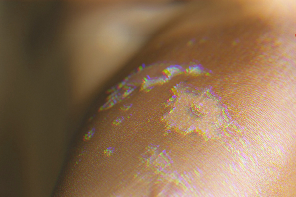 Image for illustrative purposes only. - CANVA