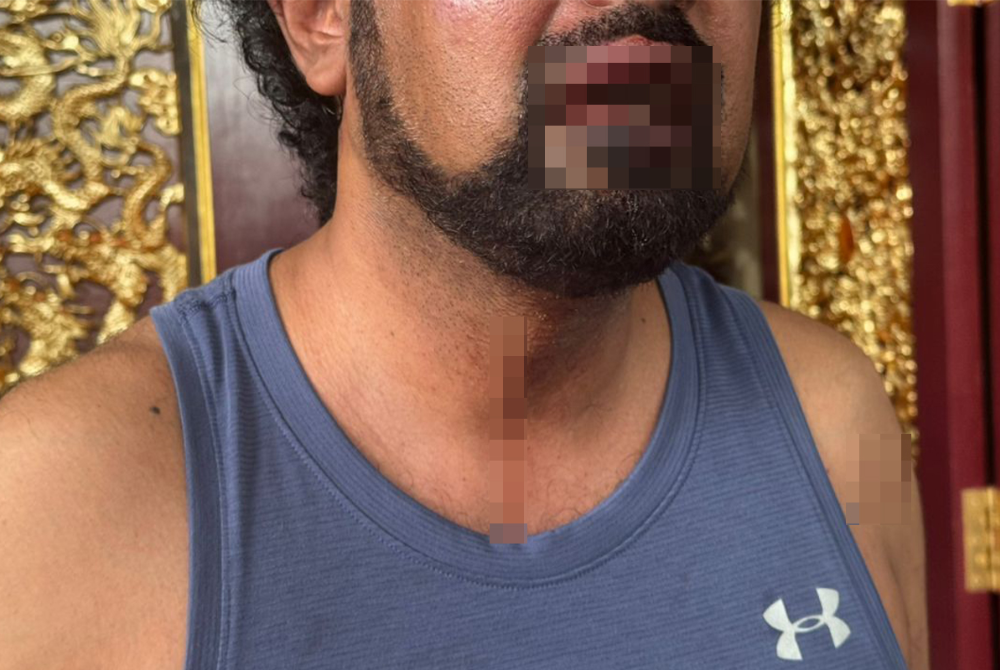 The victim, a businessman, suffered injuries on his mouth and wrist, while two of his security guards were also tied up by the attackers during the incident.