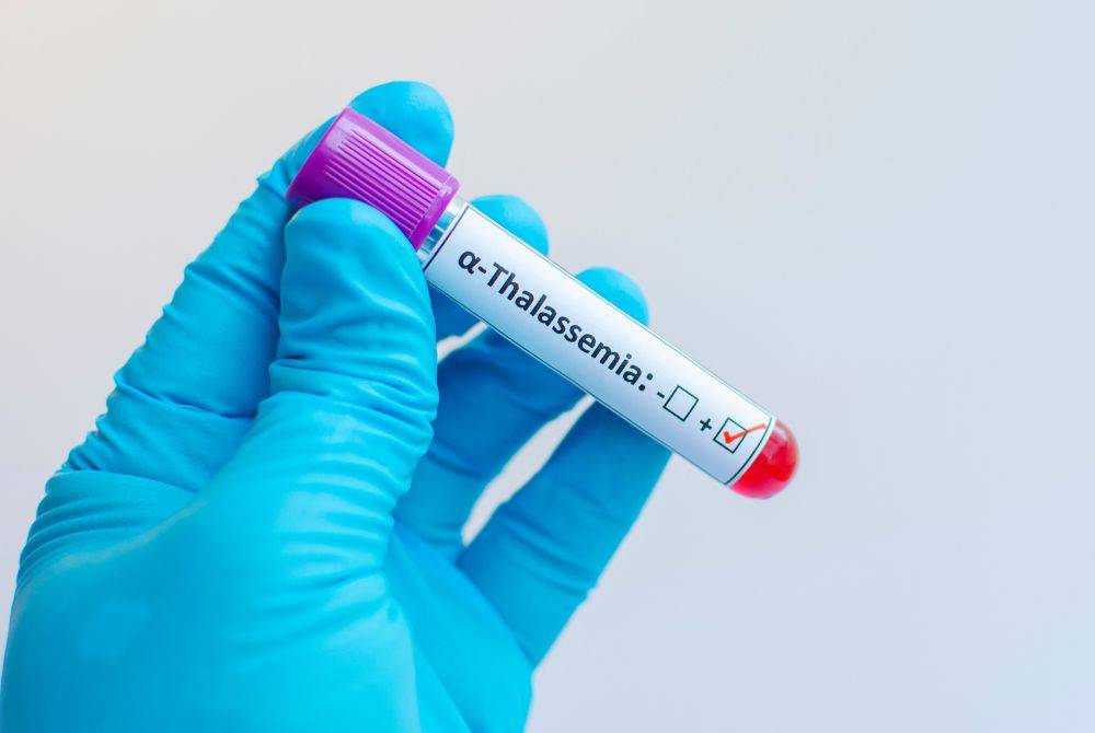Thalassemia is a hereditary blood disorder that impairs the body’s ability to produce enough haemoglobin, the protein in red blood cells responsible for transporting oxygen, due to a genetic mutation affecting its production. Photo for illustrative purposes only - Canva