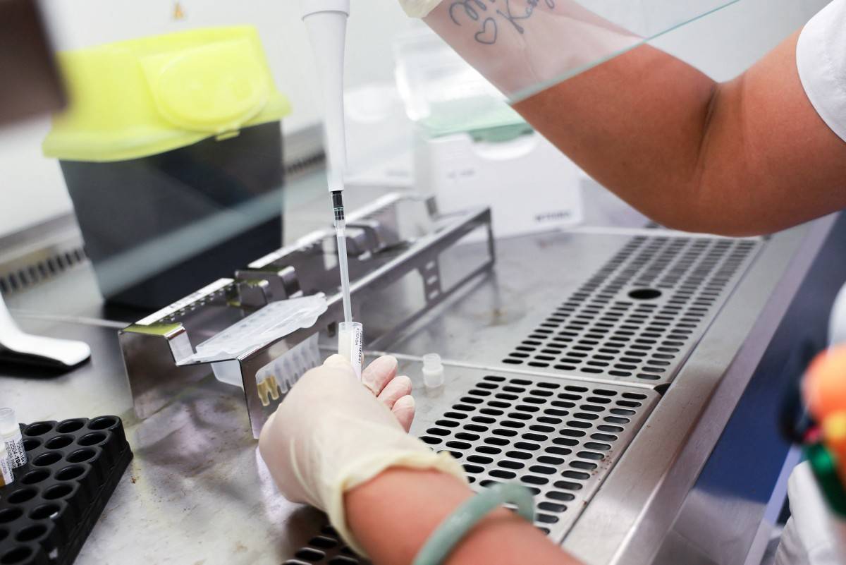A laboratory technician makes screening test during the chikungunya epidemic at the biology centre of the University Hospital Centre in Saint-Denis, France's overseas Indian ocean island of La Reunion, on April 10, 2025. The chikungunya epidemic in the Reunion island is 