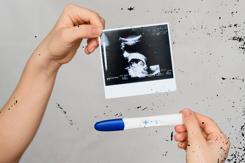 Illustration by Sinar Daily 