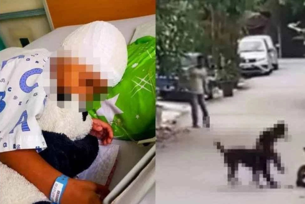A video of a boy being mauled by a dog while cycling near his home, along with images of his severe injuries, went viral on social media.