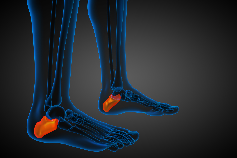 Photo for illustrative purposes only. - Photo: CANVA