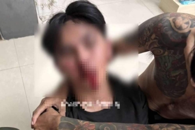 The 21-year-old victim suffered serious injuries after being attacked by the woman's boyfriend.