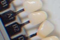 Photo for illustration purpose only. - Photo illustrated by Sinar Daily 