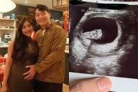 The announcement featured a heartwarming photograph of Nigel resting his hand on Sabrina’s baby bump, accompanied by an ultrasound scan. - Photo source: Uncle Roger Instagram